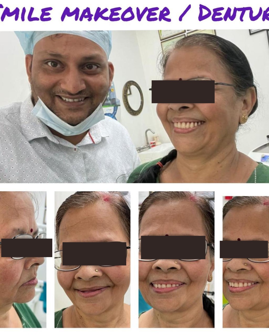 All-on-6 Dental Implants / Full Mouth Rehablitaiton - photo 2
