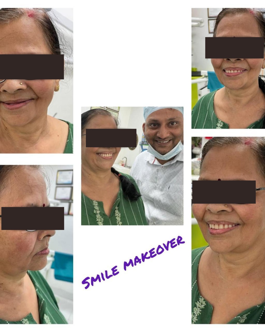 All-on-6 Dental Implants / Full Mouth Rehablitaiton - photo 3