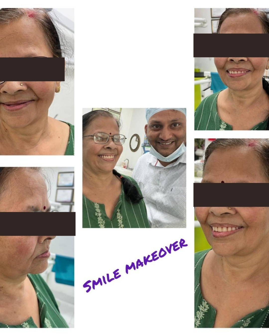 Porcelain Veneers & Smile Makeovers - photo 4